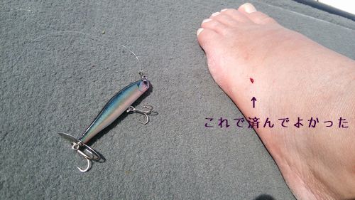 刺さった場所